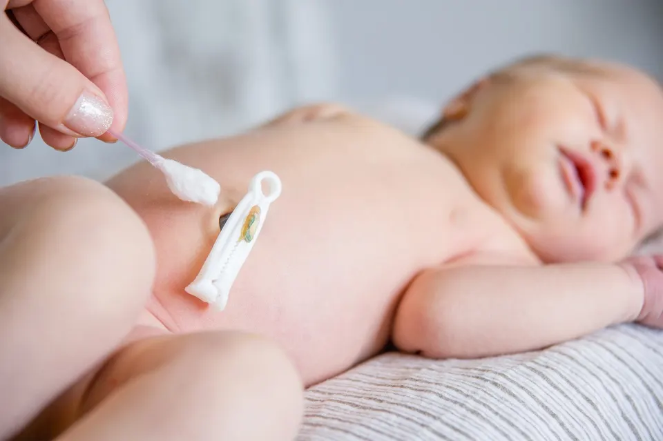 How to Care for the Navel in a Newborn Child?